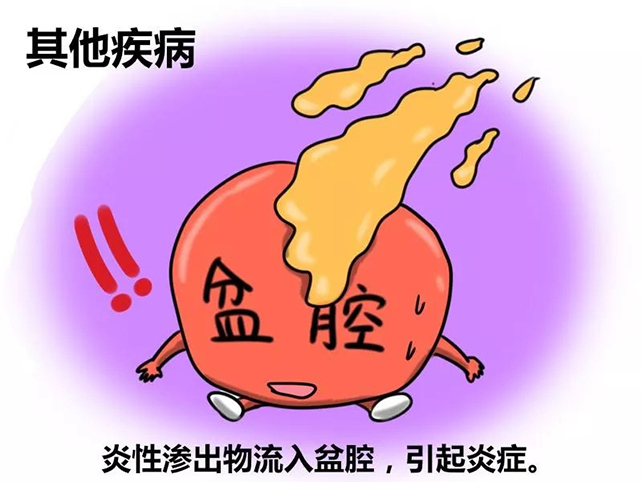 做借卵试管哪里代怀无创dna要谨慎的原因是什么？
