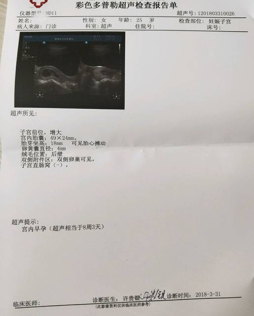 子宫纵隔生孩子会撑开系谣言!一文了解怀孕后是否会好