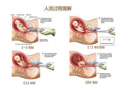 北京哪里可以做供卵试管婴儿最好