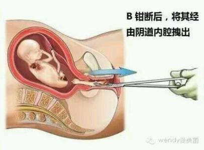 做一个试管婴儿得多少钱费用