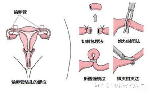 北京第九人民医院试管婴儿怎么样