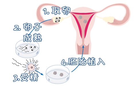 试管降调达菲林375是什么意思