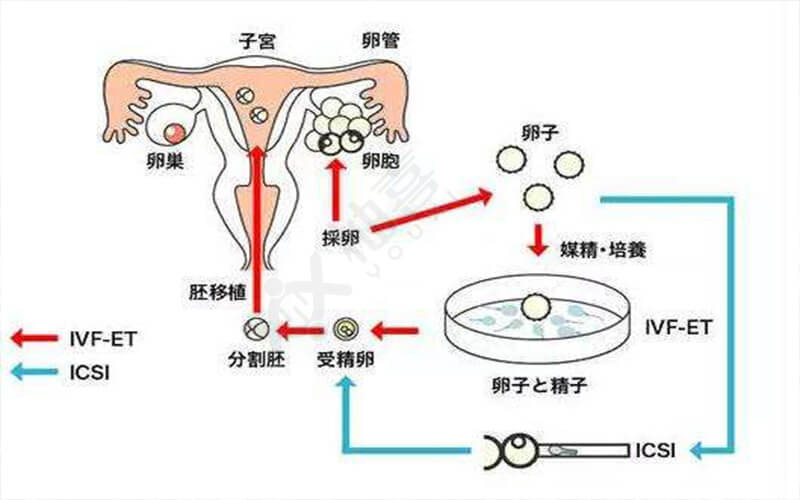 试管降调达菲林375是什么意思