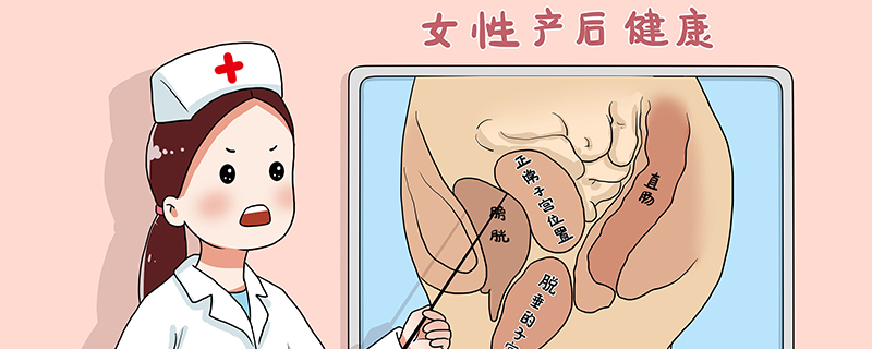 卵巢巧克力囊肿是怎么引起的