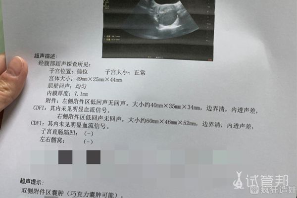 试管代怀风险大吗胚胎质量不好与哪些因素有关