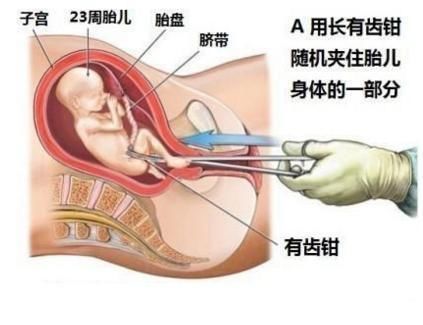 供卵成功代生的条件之染色体问题_试管代怀好妈妈会出现染色体异常吗