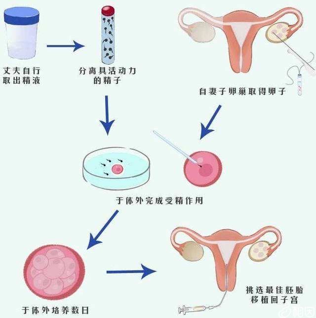 医院借卵试管代怀中心性别选择如何做到